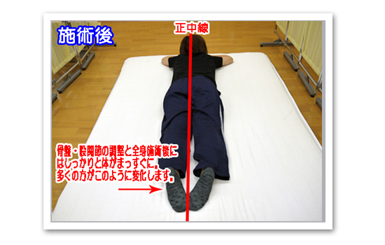 村上市の整体　樹庵の施術あと